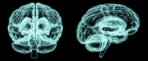 Analysis of Brain Scans Reveals Differences in Brains of Boys and Girls with Autism Spectrum Disorder Analysis of Brain Scans Reveals Differences in Brains of Boys and Girls with Autism Spectrum Disorder